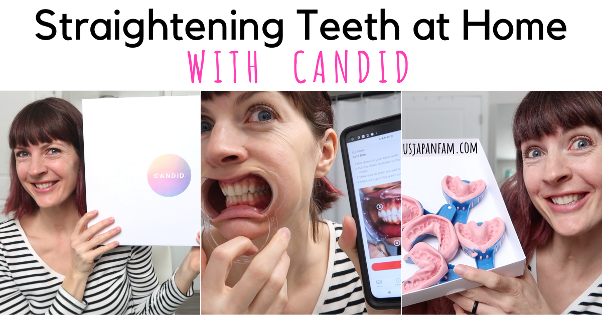 US Japan Fam - straightening teeth at home with Candid
